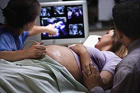 准妈妈必知的孕期常识 孕妇做b超对胎儿有影响吗