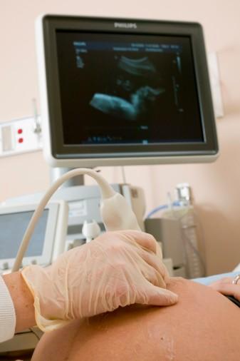 准妈妈必知的孕期常识 孕妇做b超对胎儿有影响吗(4)