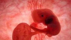 胎停有什么征兆 胚胎停育主要原因有哪些