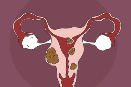 三种常见妇科病会影响怀孕
