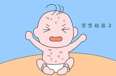 长痱子可以游泳吗 ​长痱子可以用双飞人吗