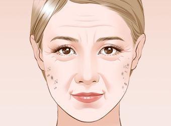 产后脸上长斑怎么办 产后脸上的斑要多久才消失